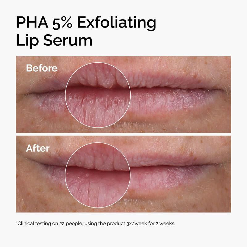 NEW the Ordinary - PHA 5% Exfoliating Lip Serum Bundles